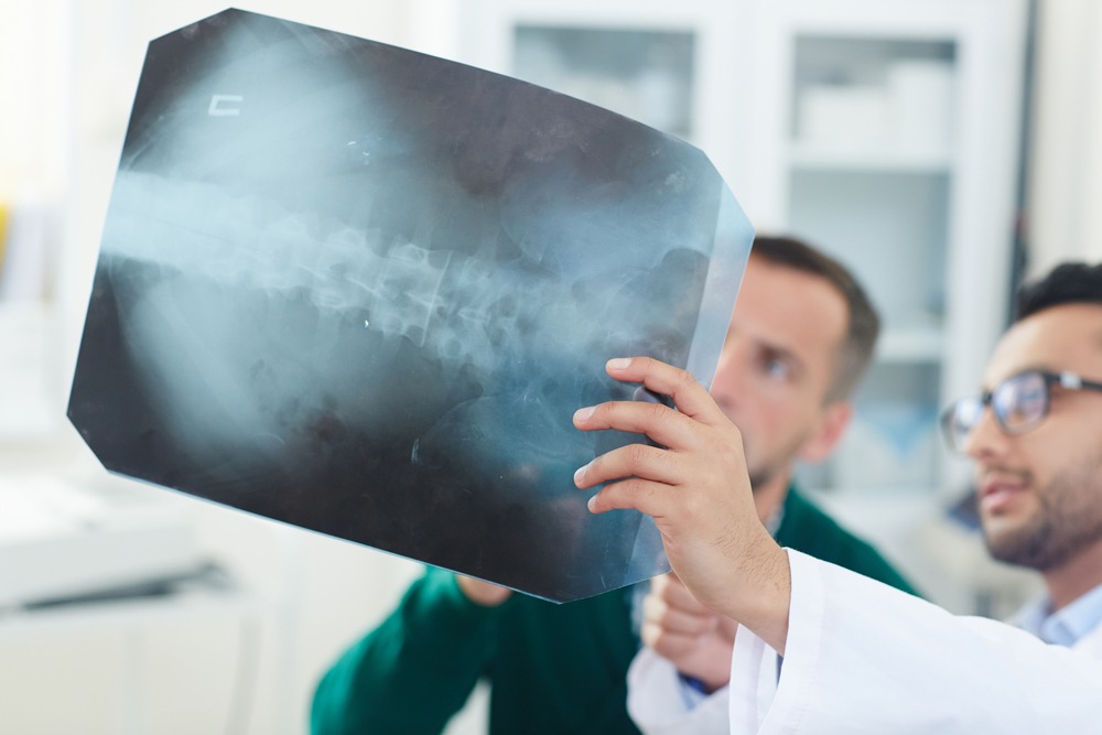 Spinal Cord Injuries Lawyer | Free Consultations