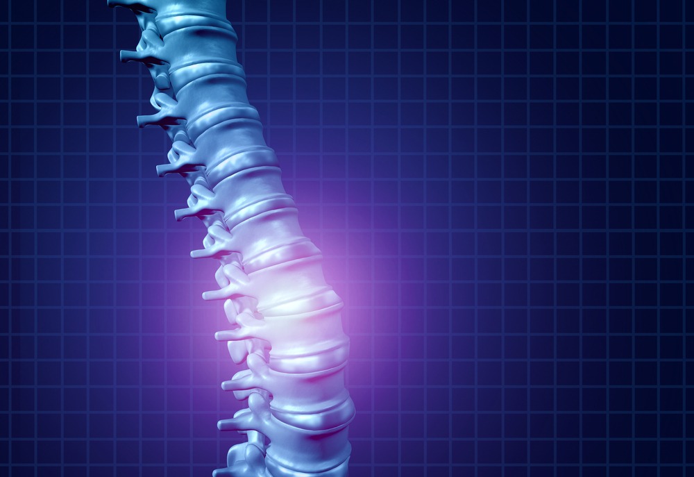 An image of a damaged spinal cord. Contact our Elk Grove spinal cord injury lawyers today for a free consultation.